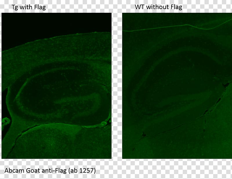 FLAG-tag Antibody Protein Desktop Immunohistochemistry, Computer transparent background PNG clipart