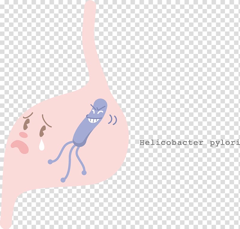 Helicobacter pylori Stomach cancer Gastritis Esophagogastroduodenoscopy, Helicobacter Pylori Eradication Protocols transparent background PNG clipart