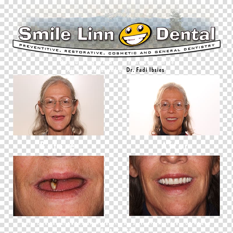 Smile Linn Dental: Ibsies Fadi B DMD Dentistry Lake Oswego Mouth, Smile dental transparent background PNG clipart