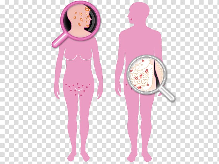 Sexually transmitted infection Reproductive health Contagi Disease, health transparent background PNG clipart