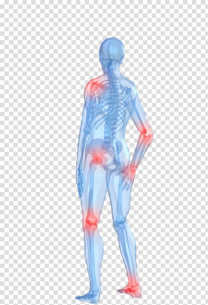 Arthritis pain Human body Rheumatoid arthritis Joint pain, body pain transparent background PNG clipart