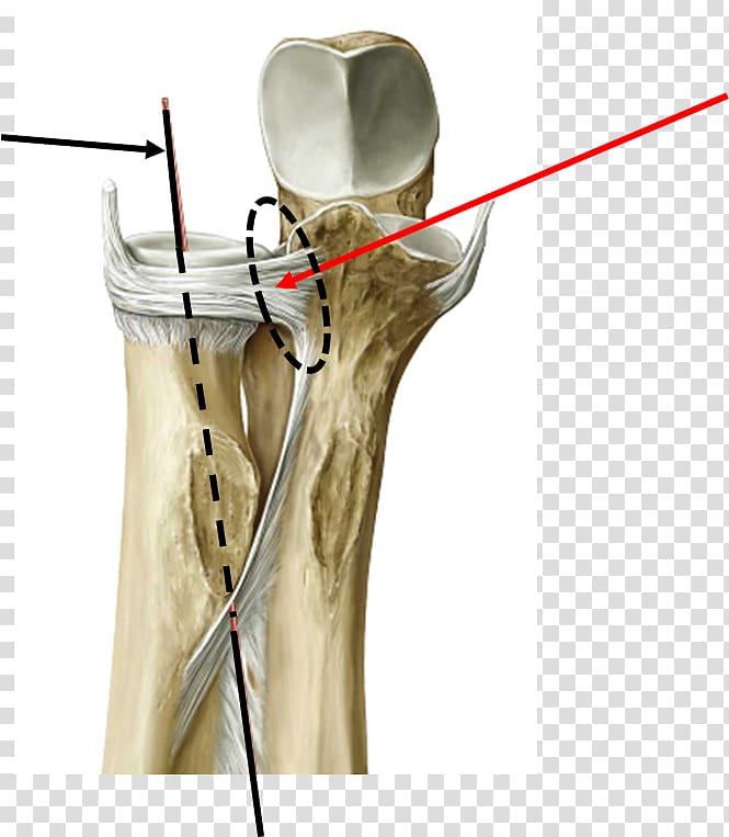 Joint Distal radioulnar articulation Proximal radioulnar articulation Ligament, joint transparent background PNG clipart