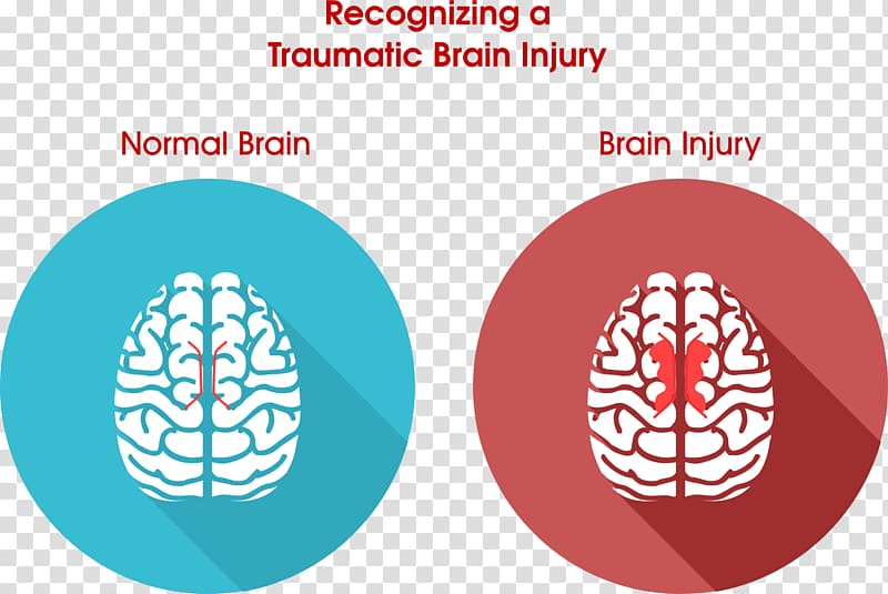 Traumatic brain injury Concussion Acquired brain injury, injury transparent background PNG clipart