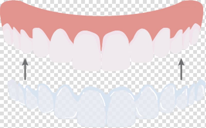 Tooth Jaw Mouth Pink M, design transparent background PNG clipart