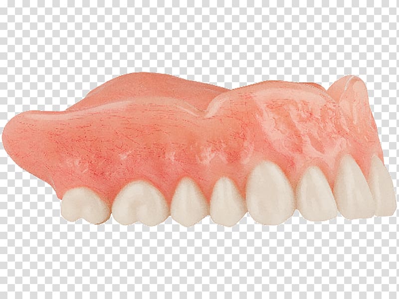 Human tooth Dentures, denture transparent background PNG clipart