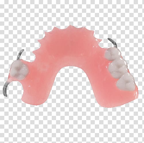 Dentures Removable partial denture Dentistry Dental laboratory Jaw, others transparent background PNG clipart