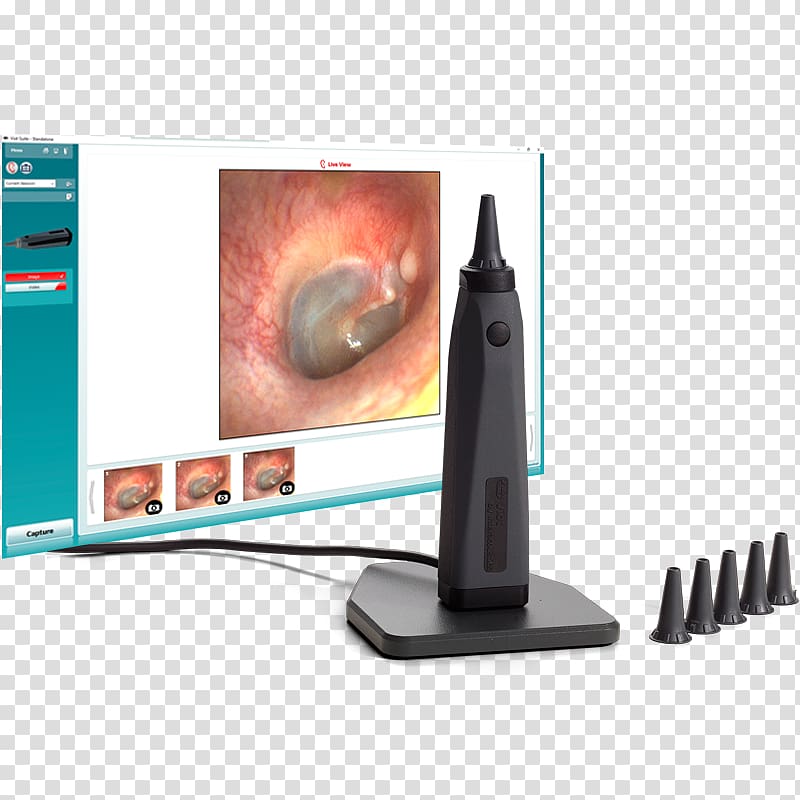 Otoscope Audiometry Computer Monitors Otoscopia Otoskopie, Ahsaudiology Hearing Solutions transparent background PNG clipart