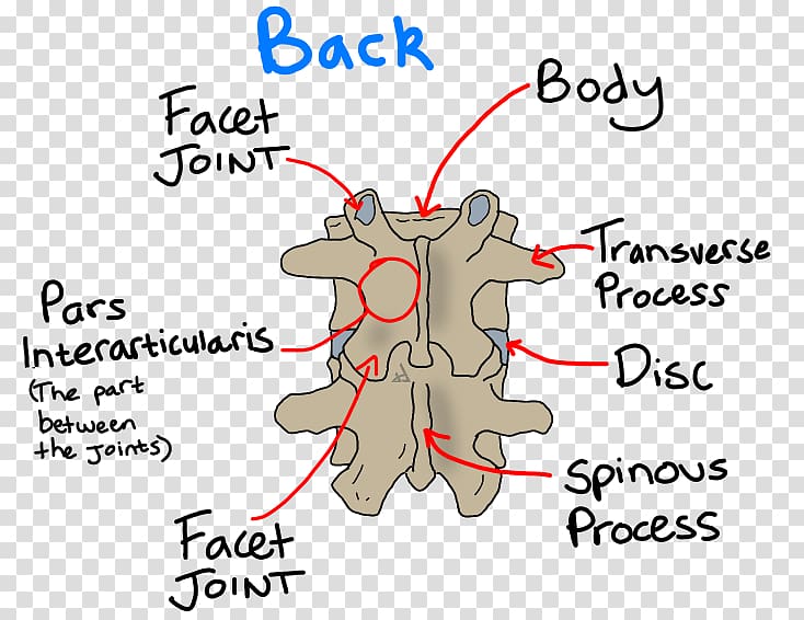 Pars interarticularis Spondylolysis Spondylolisthesis Vertebral column, spine transparent background PNG clipart