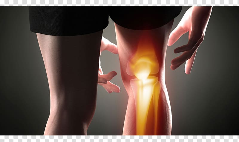 Knee pain Knee arthritis Pain management Osteoarthritis, joint pain transparent background PNG clipart