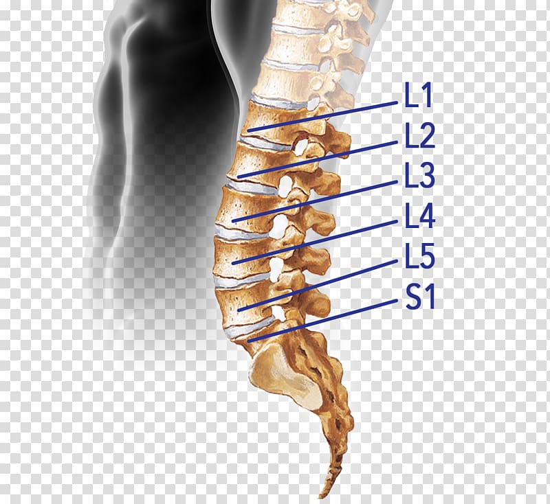 Vertebral column Spinal disc herniation Intervertebral disc Lumbar vertebrae Spinal cord, sacrum bone pain transparent background PNG clipart
