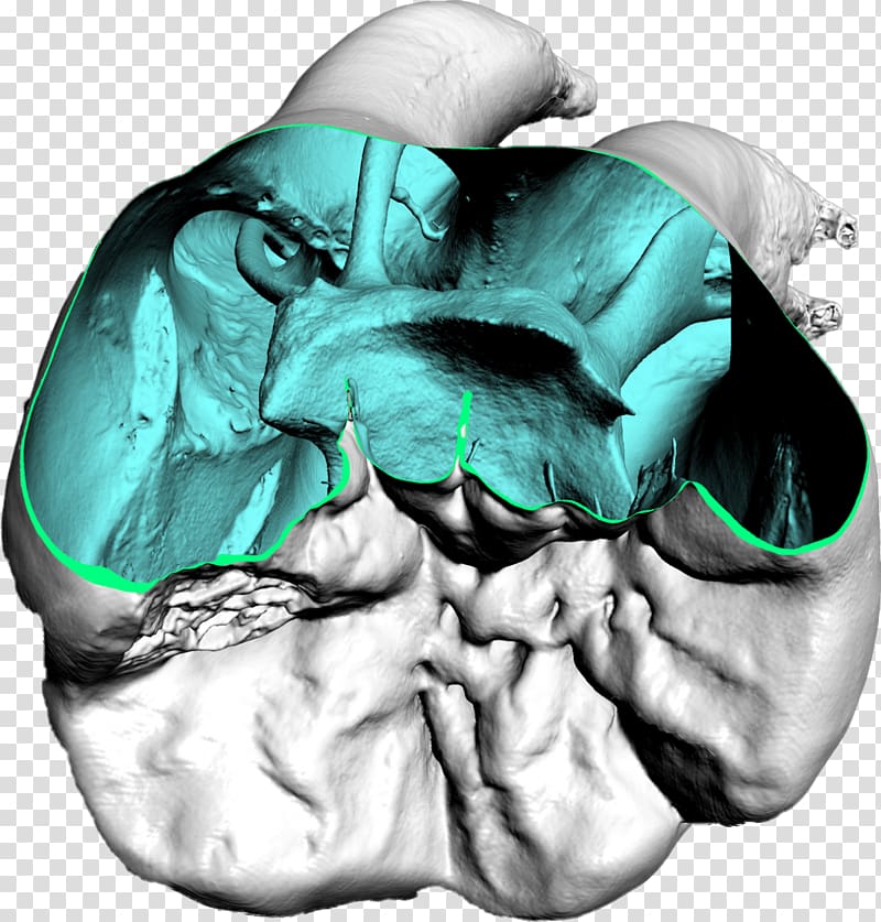 Dentistry Computed tomography Dental impression, x-ray transparent background PNG clipart