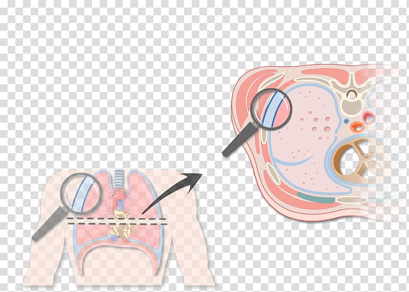 Pulmonary pleurae Pleural cavity Thoracic cavity Pleural effusion Lung, others transparent background PNG clipart