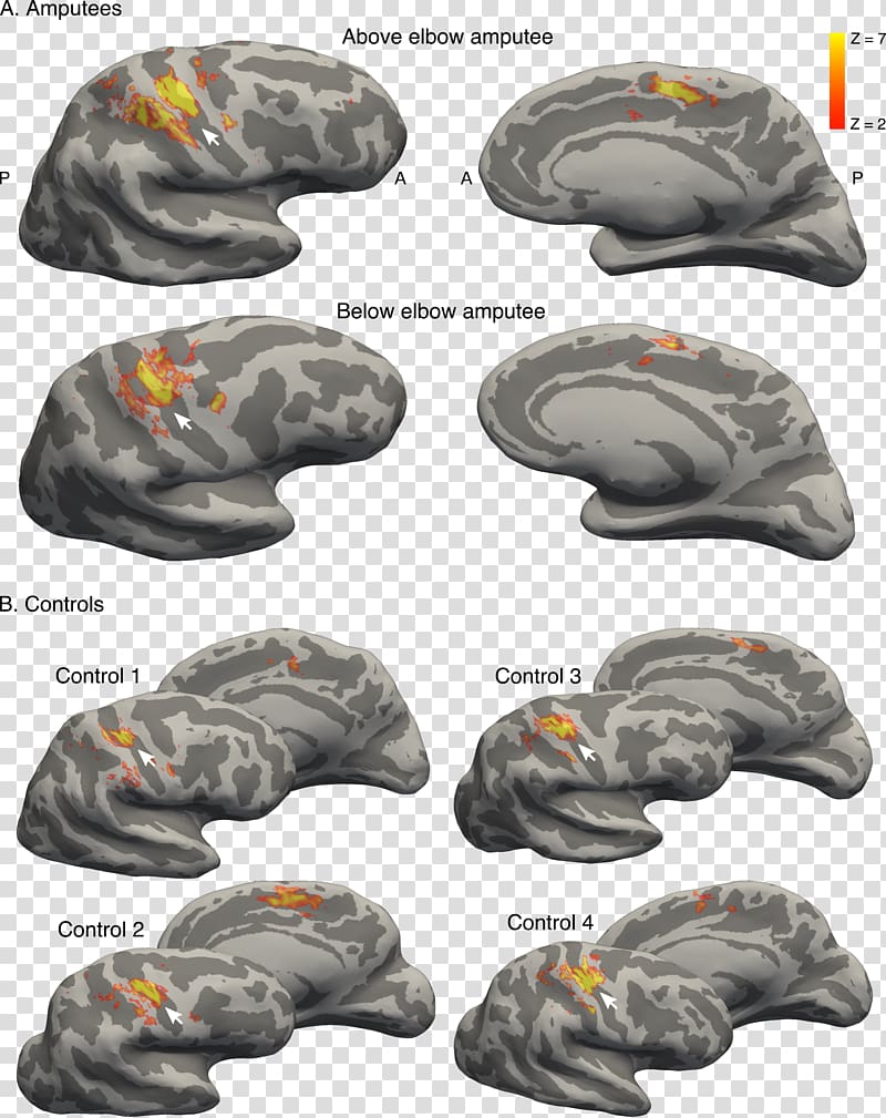 Brain Primary somatosensory cortex Finger Cerebral cortex Nervous system, Brain transparent background PNG clipart