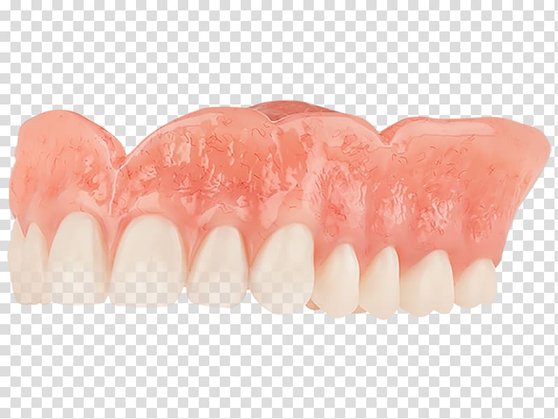 Dentures Oral hygiene Dentistry Tooth, dentistry transparent background PNG clipart