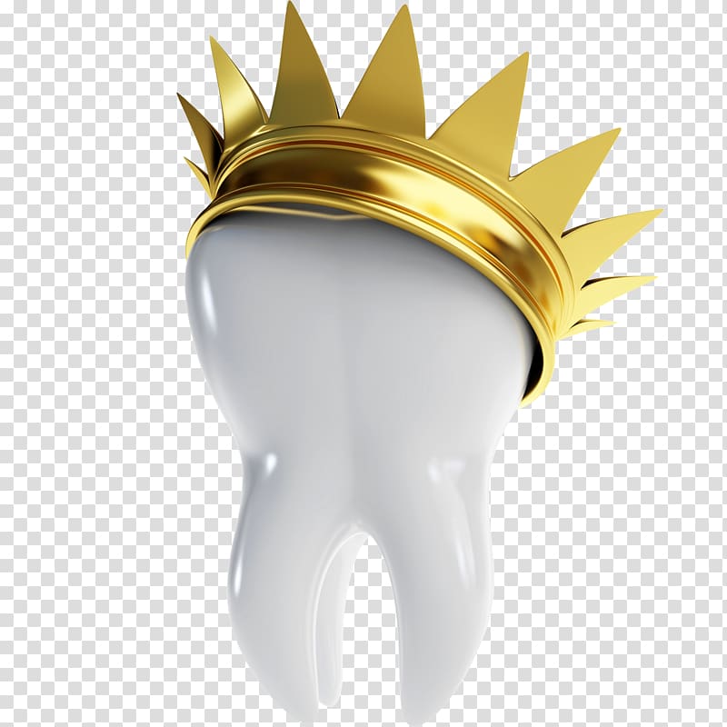 Dentistry Bridge Crown Dental implant, root canal treatment transparent background PNG clipart