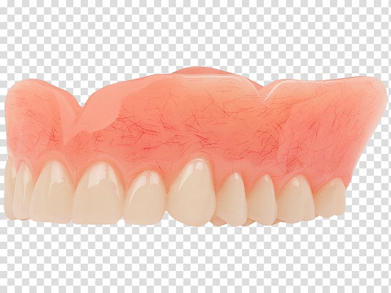 Tooth Dentistry Dentures Aspen Dental, denture transparent background PNG clipart