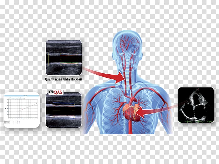 Health Care Sports medicine Ultrasonography, others transparent background PNG clipart