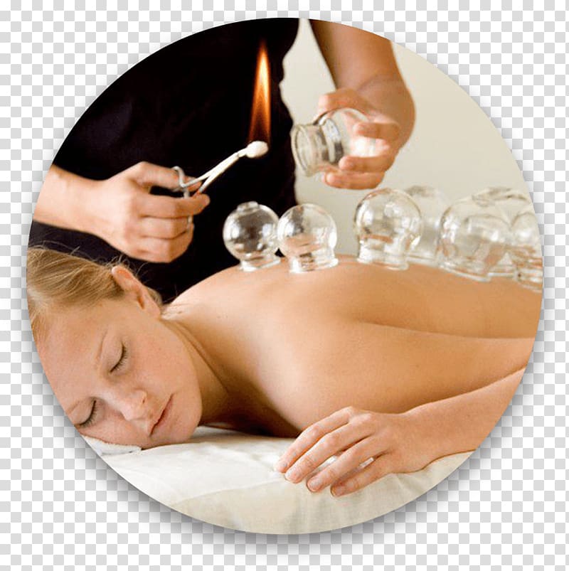 Cupping therapy Massage Traditional Chinese medicine Acupuncture, Cupping Therapy transparent background PNG clipart