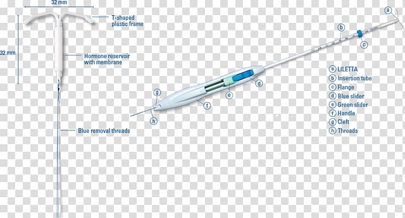 Progestin IUD Intrauterine device Birth control Copper IUDs Levonorgestrel, others transparent background PNG clipart