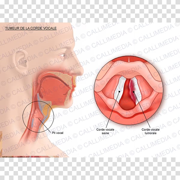 Vocal folds Cancer Human anatomy Vowel, CORDE transparent background PNG clipart