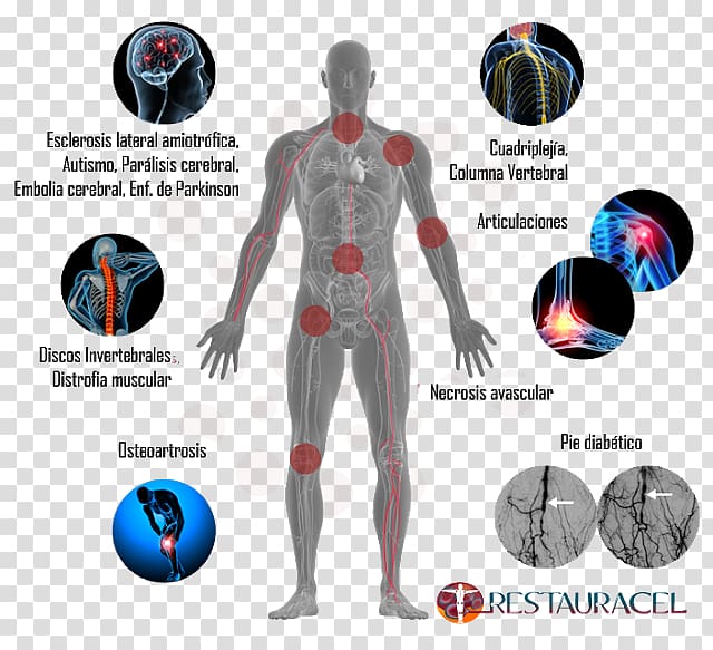 Stem cell Stem-cell therapy Human body, artrosis de rodilla transparent background PNG clipart