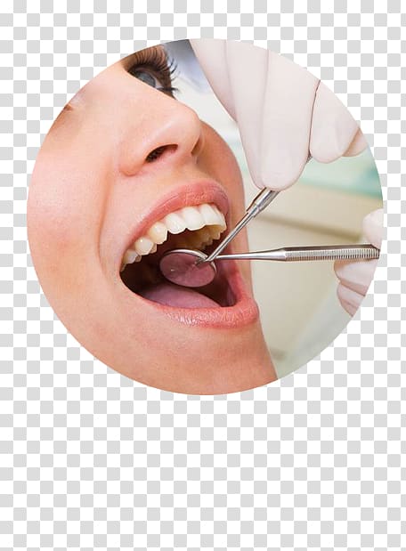 woman taking dental check-up, Oral hygiene Dentistry Teeth cleaning Dental restoration, Cosmetic Dentistry transparent background PNG clipart