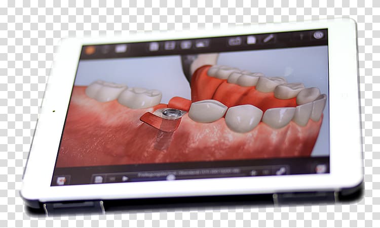 iPad 2 Netbook Dentist Implantology Dental implant, doctor with ipad transparent background PNG clipart