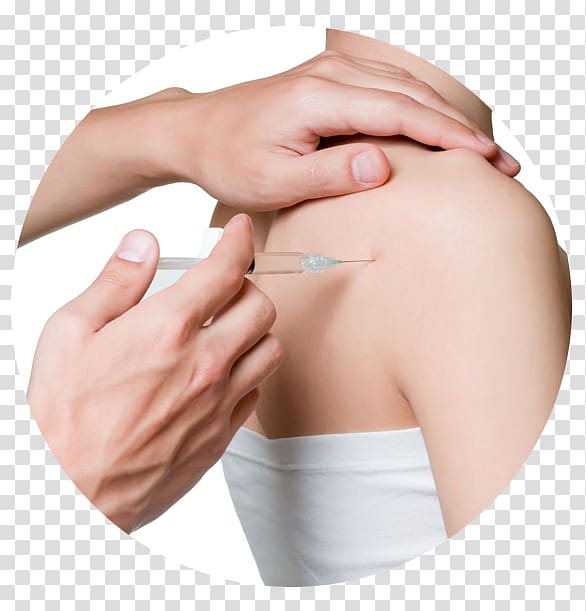 Myofascial trigger point Joint injection Therapy Medicine, Orthopedics transparent background PNG clipart