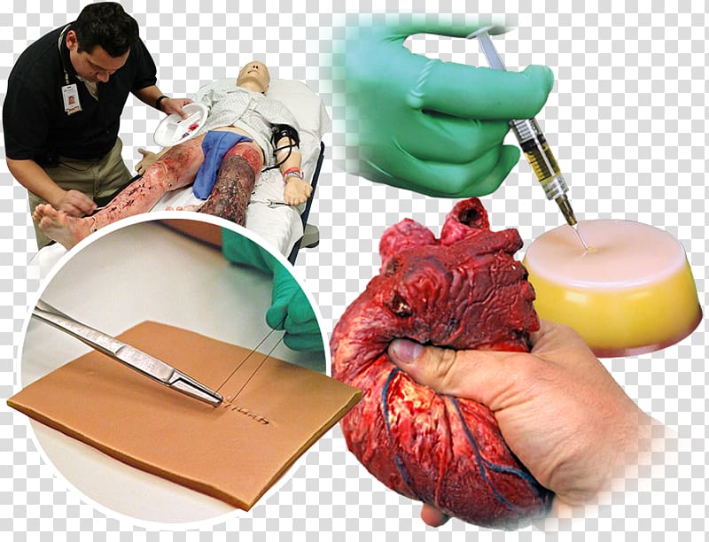 Medical simulation Surgical suture Medicine Surgery, others transparent background PNG clipart