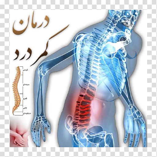 Pain in spine Lumbar disc herniation Low back pain Vertebral column, backpain transparent background PNG clipart