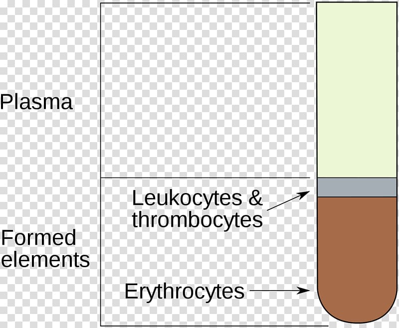 Hematocrit Packed red blood cells Anemia, blood transparent background PNG clipart