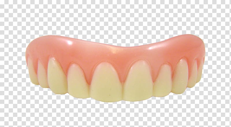 Veneer Dentures Dentistry Tooth Cosmetics, teeth transparent background PNG clipart