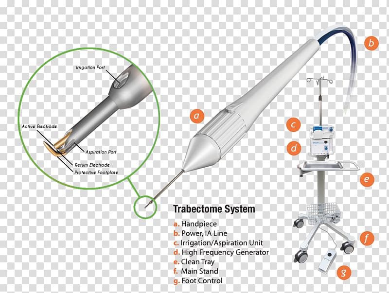 Trabectome Glaucoma surgery Ophthalmology Glaucoma surgery, System transparent background PNG clipart