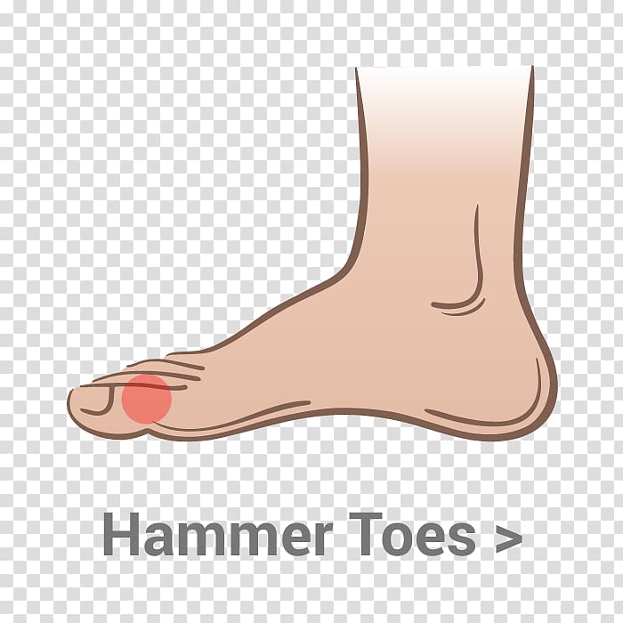 Thumb Toe Shoe Bent finger Ball, ankle Pain transparent background PNG clipart