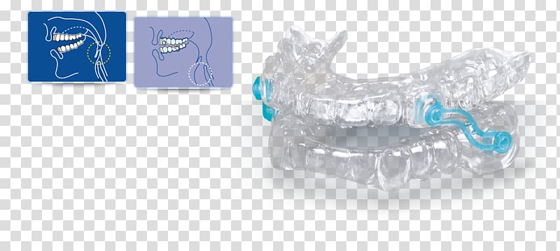 Snoring Dentistry Apnea Upper airway resistance syndrome, open an account freely transparent background PNG clipart