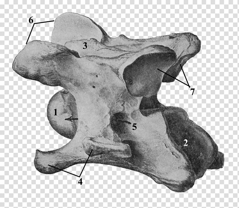 Cervical vertebrae Axis Anatomy Skull, others transparent background PNG clipart