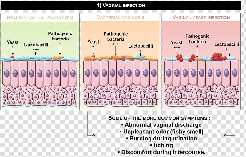 Vaginitis Disease Naver Blog Candidiasis Therapy, infection transparent background PNG clipart