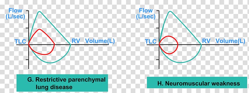 Pulmonary function testing Spirometry Exploration fonctionnelle Lung Breathing, Pulmonary Function Testing transparent background PNG clipart