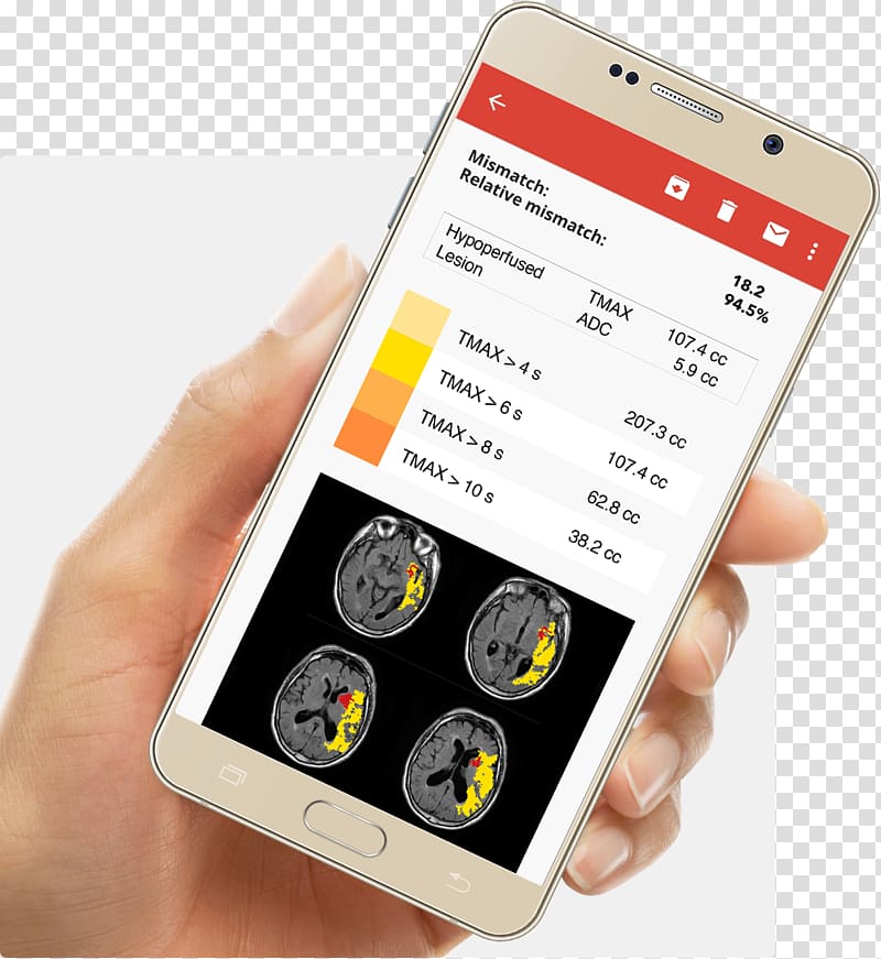 Smartphone La Ciotat Olea Medical Perfusion MRI Mobile Phones, smartphone transparent background PNG clipart