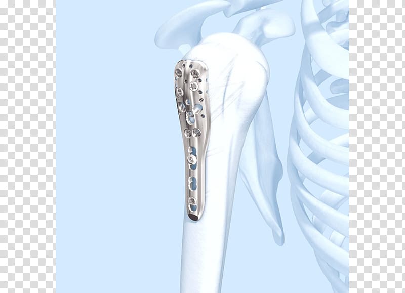 Shoulder Humerus fracture Bone Diaphysis, others transparent background PNG clipart
