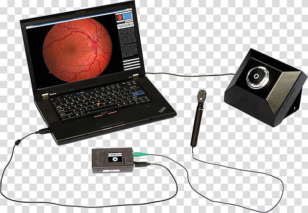 Ophthalmoscopy Simulation Virtual reality simulator Virtuality, others transparent background PNG clipart