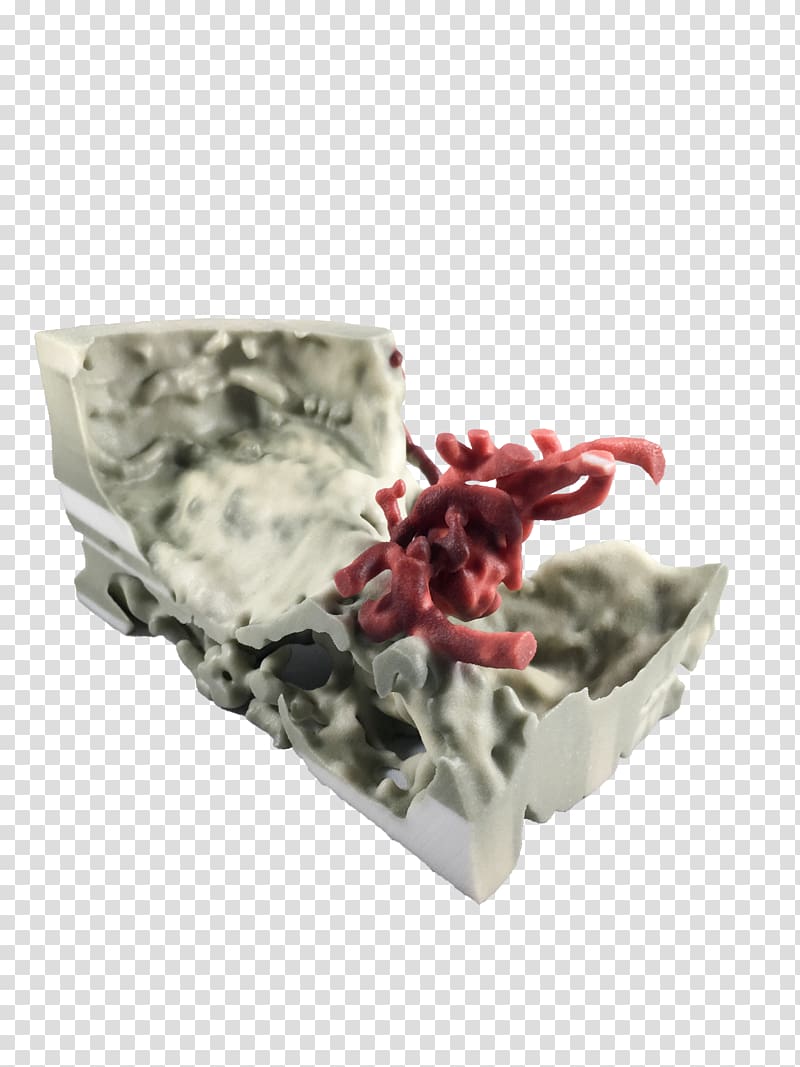 3D printing 3D computer graphics Neuroradiology Stanford Radiology 3D and Quantitative Imaging Lab, brain watercolor transparent background PNG clipart