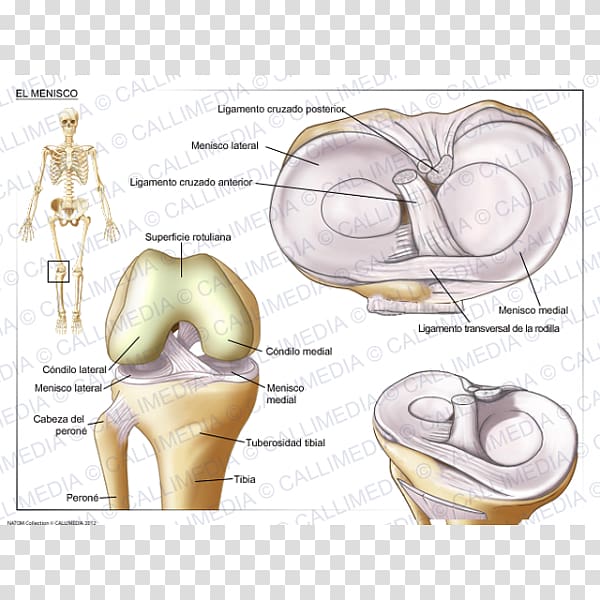 Tear of meniscus Knee Joint, ear transparent background PNG clipart