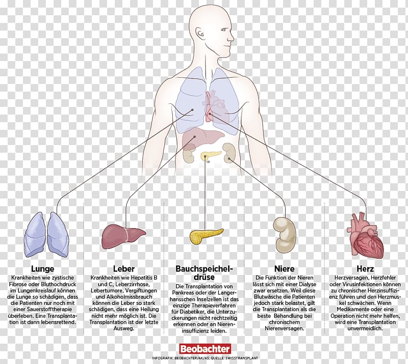 Organ transplantation Organ donation Donorcodicil Switzerland, Organ Transplantation transparent background PNG clipart