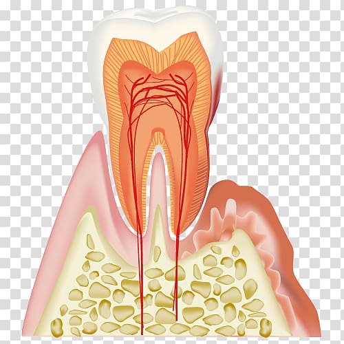 Periodontal disease Dentistry Gums, others transparent background PNG clipart