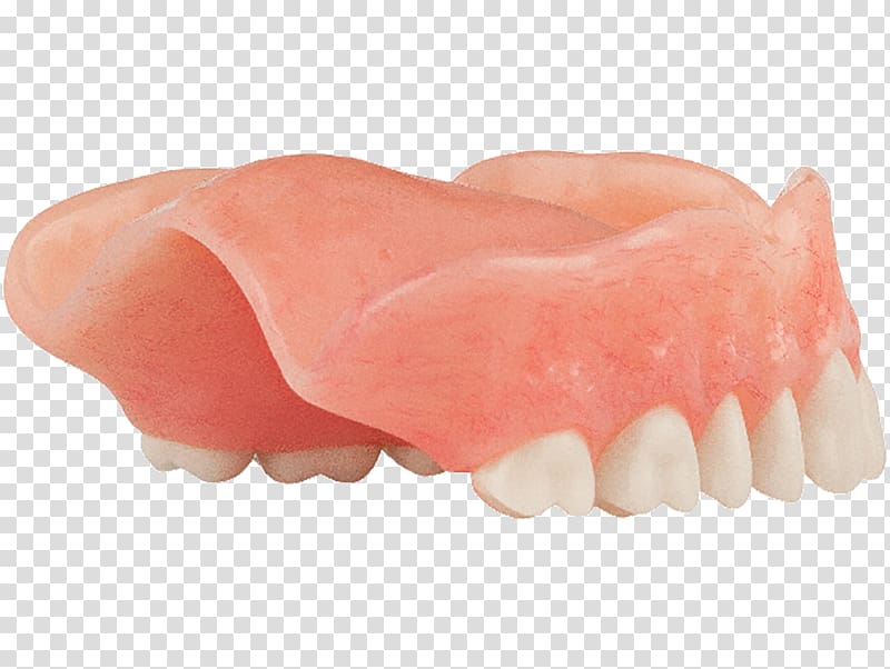 Tooth Dentures Dentistry Jaw Dental implant, Aspen Dental transparent background PNG clipart