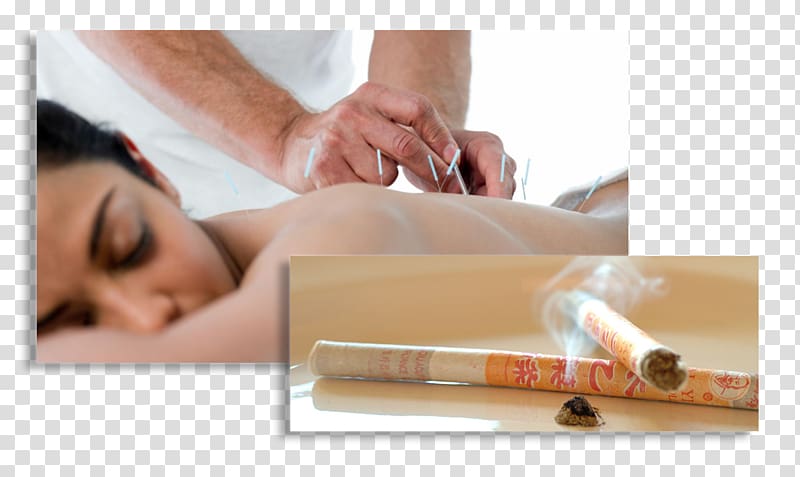 Massage Alternative Health Services Acupuncture North Dakota, Acupuntura transparent background PNG clipart