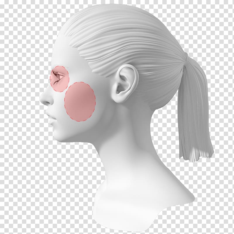 Perioral dermatitis Acne Cosmetics Chin, pimple transparent background PNG clipart