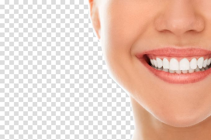 woman smiling, Dentistry Oral hygiene Dental implant Dental public health, Teeth model transparent background PNG clipart