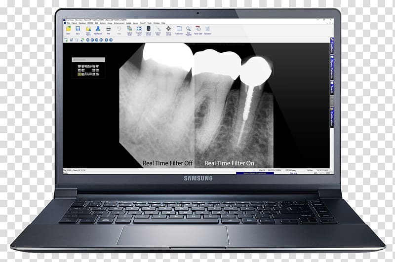 Netbook Laptop Personal computer Mockup Screenshot, laptop display mockup transparent background PNG clipart